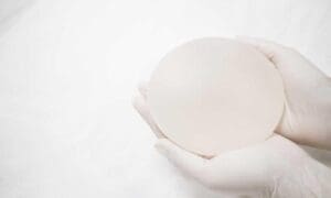 Breast Implant Revision, Daniel Brown M.D