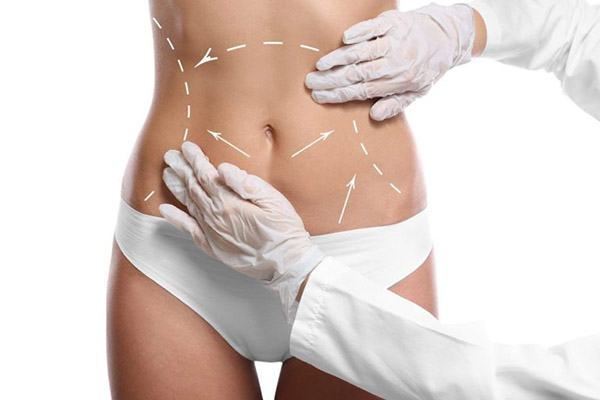 Liposuction vs. Tummy Tuck, Daniel Brown M.D