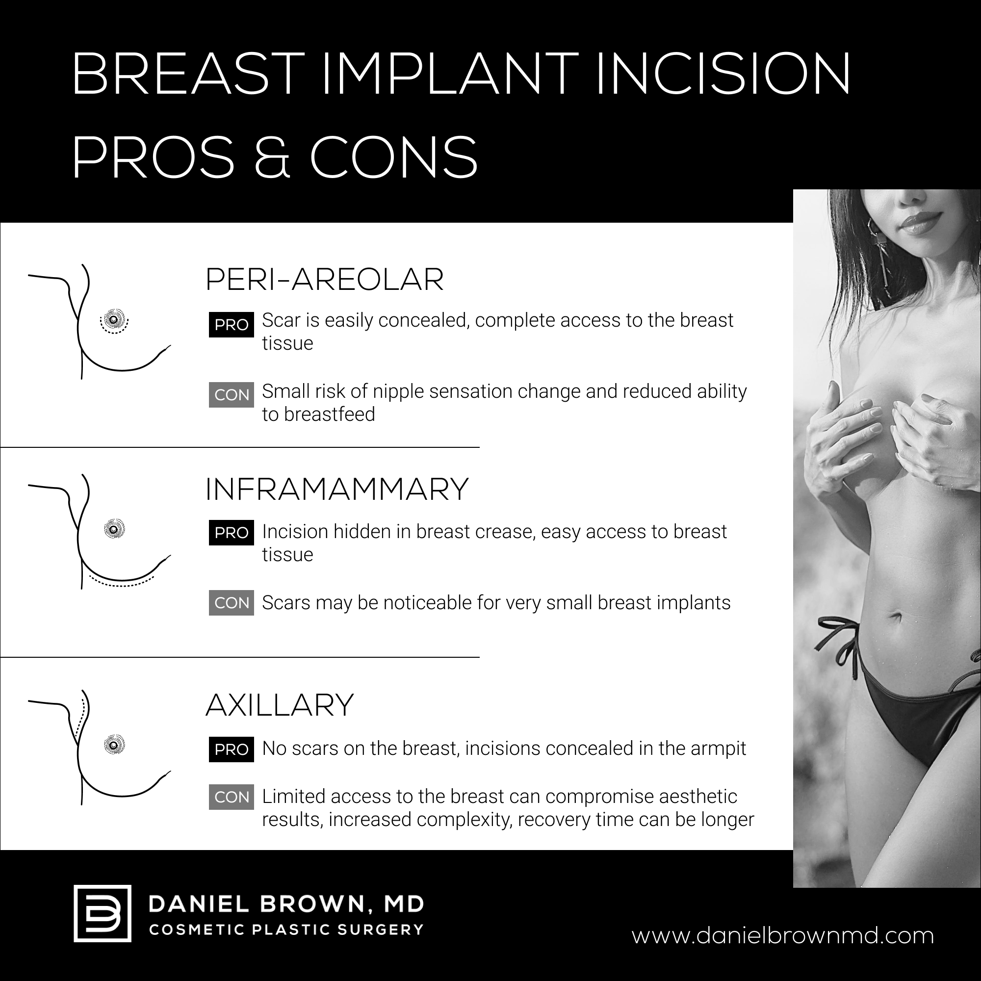 Breast Implant Incision Pros &#038; Cons [Infographic], Daniel Brown M.D
