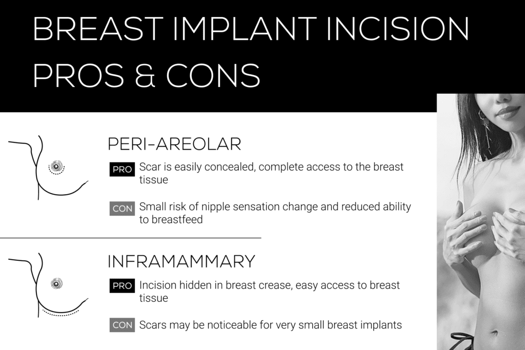 Breast Implant Incision Pros & Cons