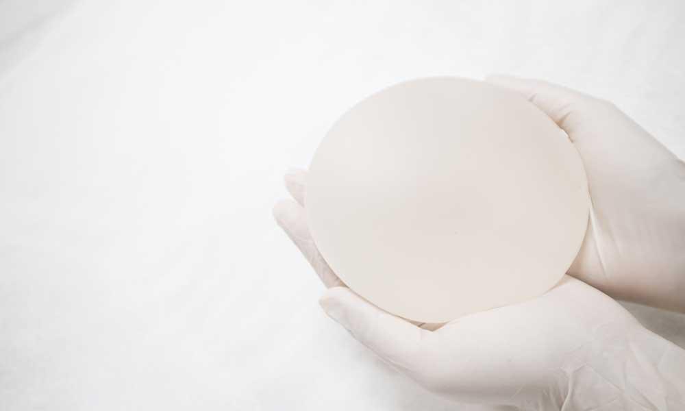 breast augmentation revision