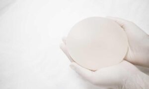 BREAST AUGMENTATION REVISION