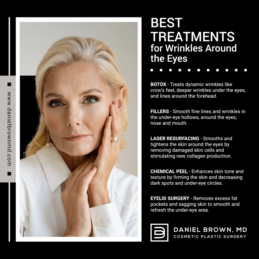 Best Treatments for Wrinkles Around the Eyes 