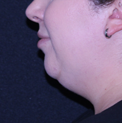 B&A